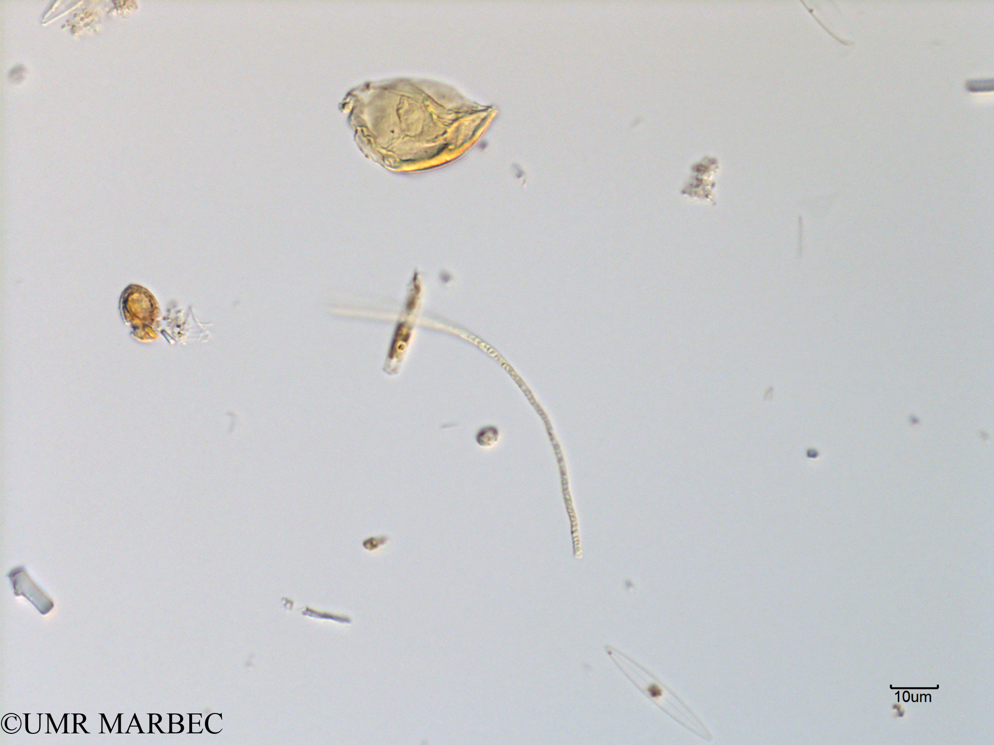 phyto/Scattered_Islands/mayotte_lagoon/SIREME May 2016/Oscillatoriale spp (MAY11_cyano-1).tif(copy).jpg
